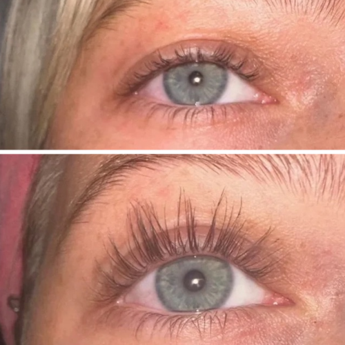 Buy Bimatoprost serum
