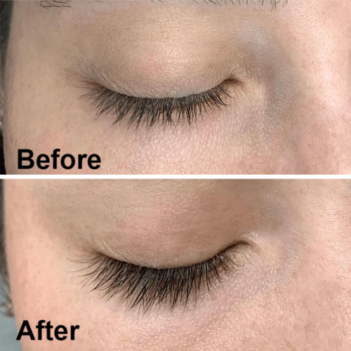 Order Latisse with fast shipping
