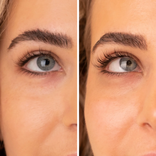 Purchase Latisse for eyelash growth