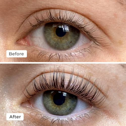 Bimat serum before and after
