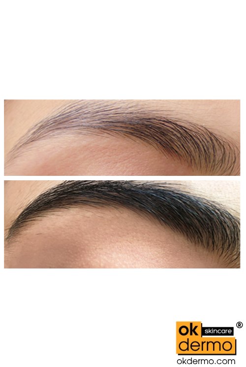 latisse for eyebrows before and after