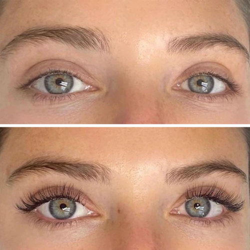 Latisse Lashes