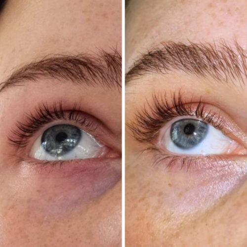 Careprost Eyelash Growth Serum