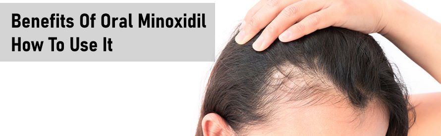 Oral Minoxidil for hair loss  fact sheet and definitive guide   Dermatologist