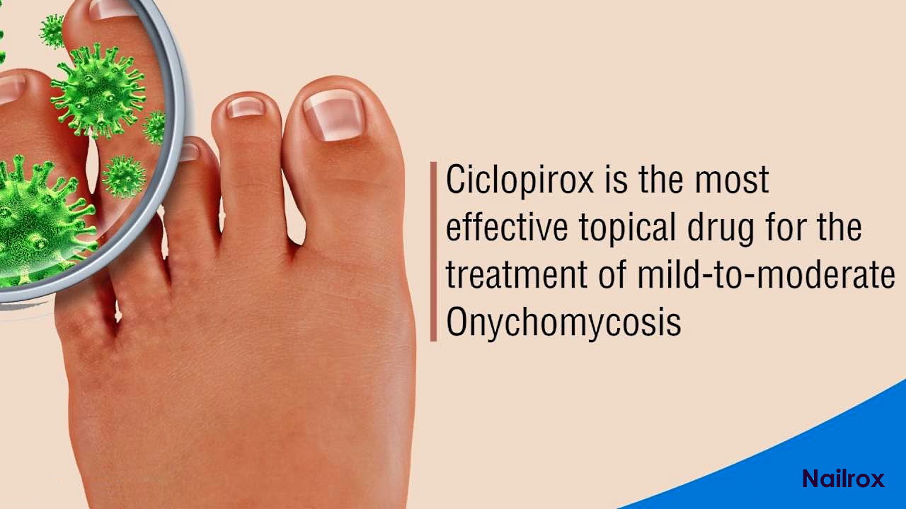 what is ciclopirox olamine cream used for