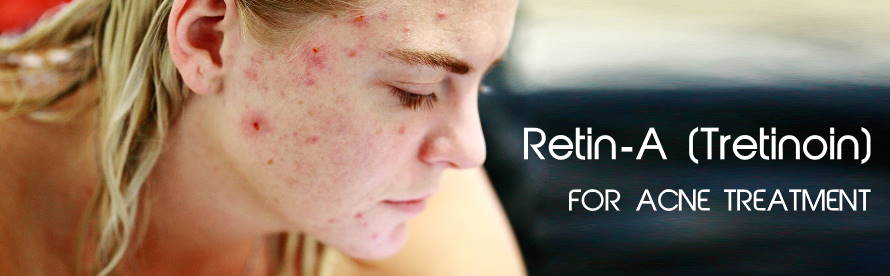 Retin-A Tretinoin For Acne Treatment