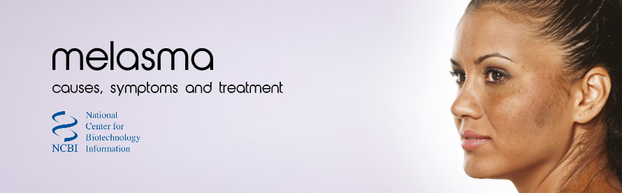 Topical Treatment Of Melasma: Causes. Symptoms. Treatment
