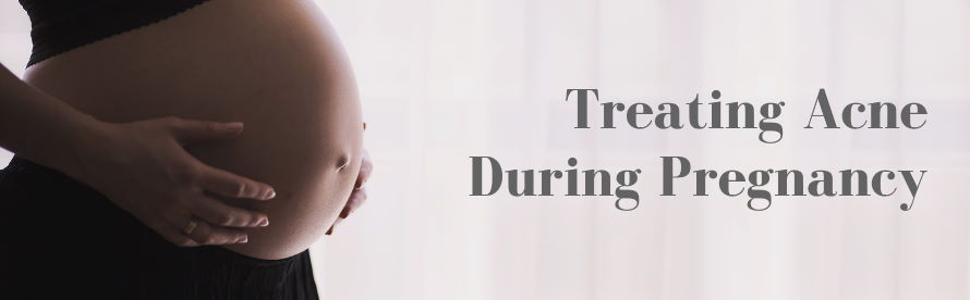 Treting Acne During Pregnancy