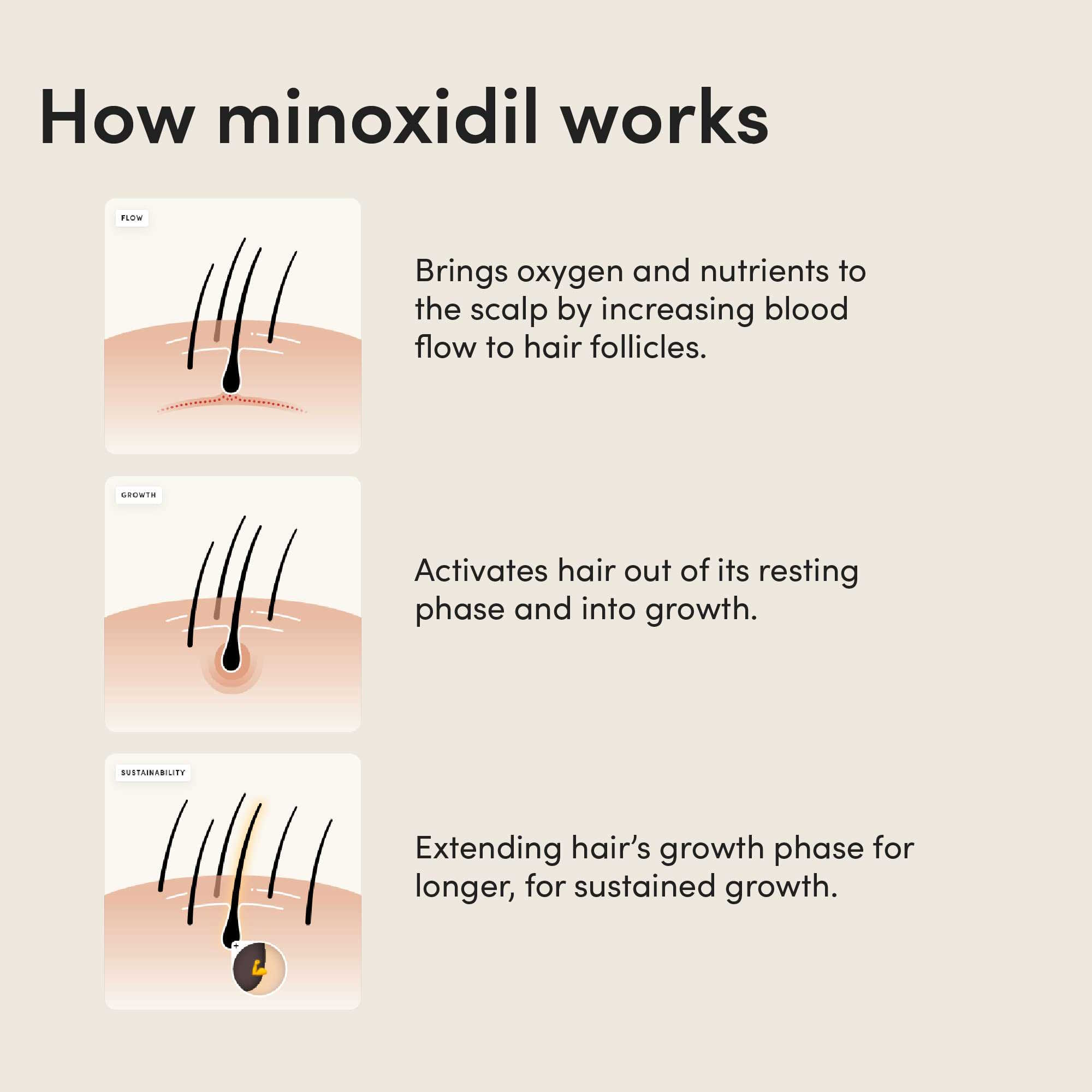 can minoxidil cause hair loss 