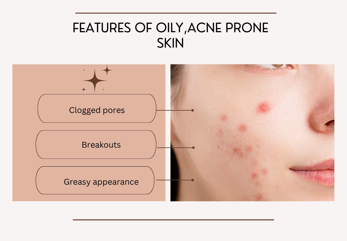 dermatologist recommended moisturizer for oily skin