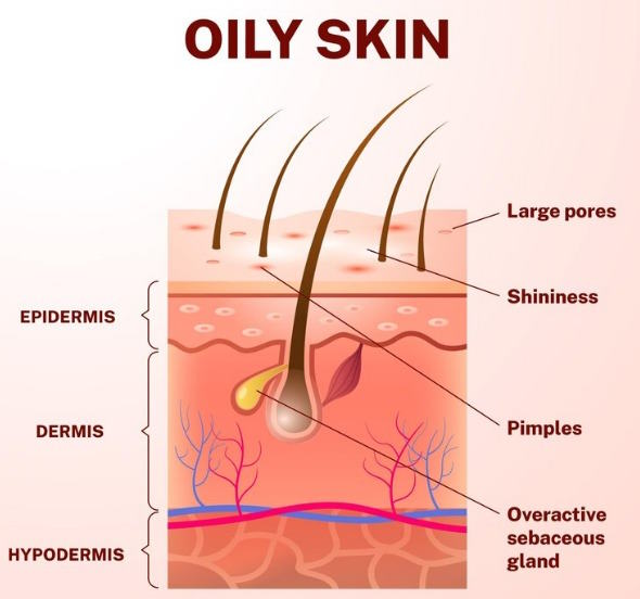 non comedogenic moisturizer for oily skin